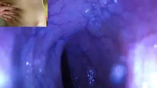 POV – The view staring up my descending colon as I mush you from the outside